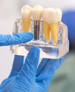 implantes destacado Tident Dentistas en Miajadas
