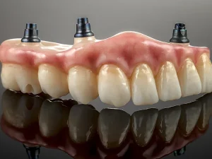 implantes tratamiento Tident Dentistas en Miajadas