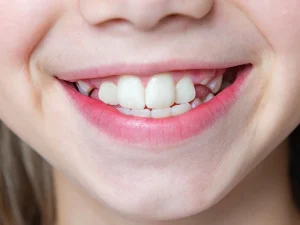 ortodoncia tratamiento Tident Dentistas en Miajadas