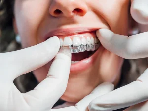 ortodoncia tratamiento Tident Dentistas en Miajadas
