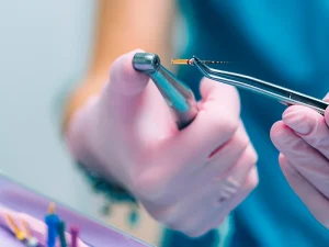 odontologia general endodoncia Tident Dentistas en Miajadas