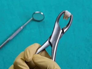odontologia general extracciones Tident Dentistas en Miajadas