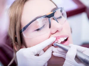 odontologia general limpieza