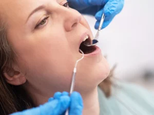 periodoncia tratamiento