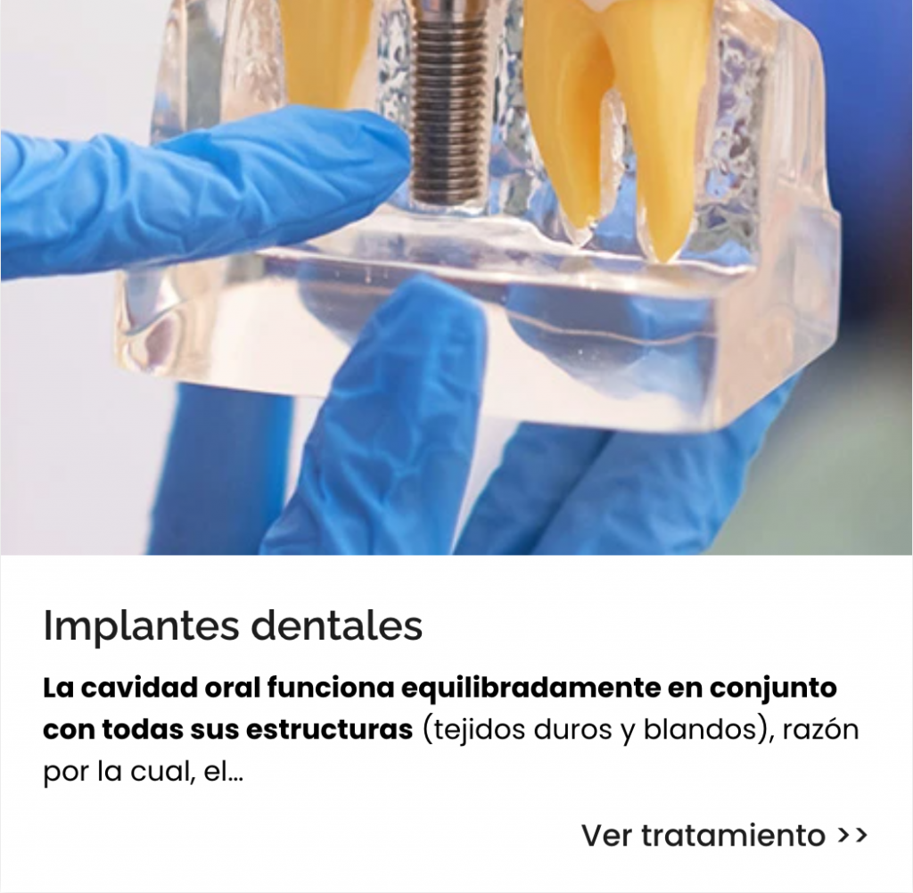 IMPLANTES DENTALES EN MIAJADAS
